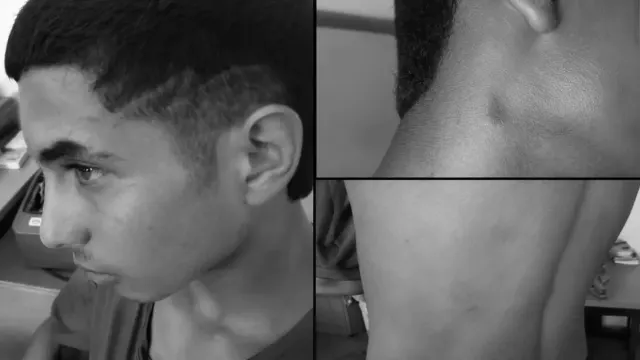 Imagen de Madre cubana denuncia la detención y golpiza de su hijo de 13 años tras protestas en La Habana